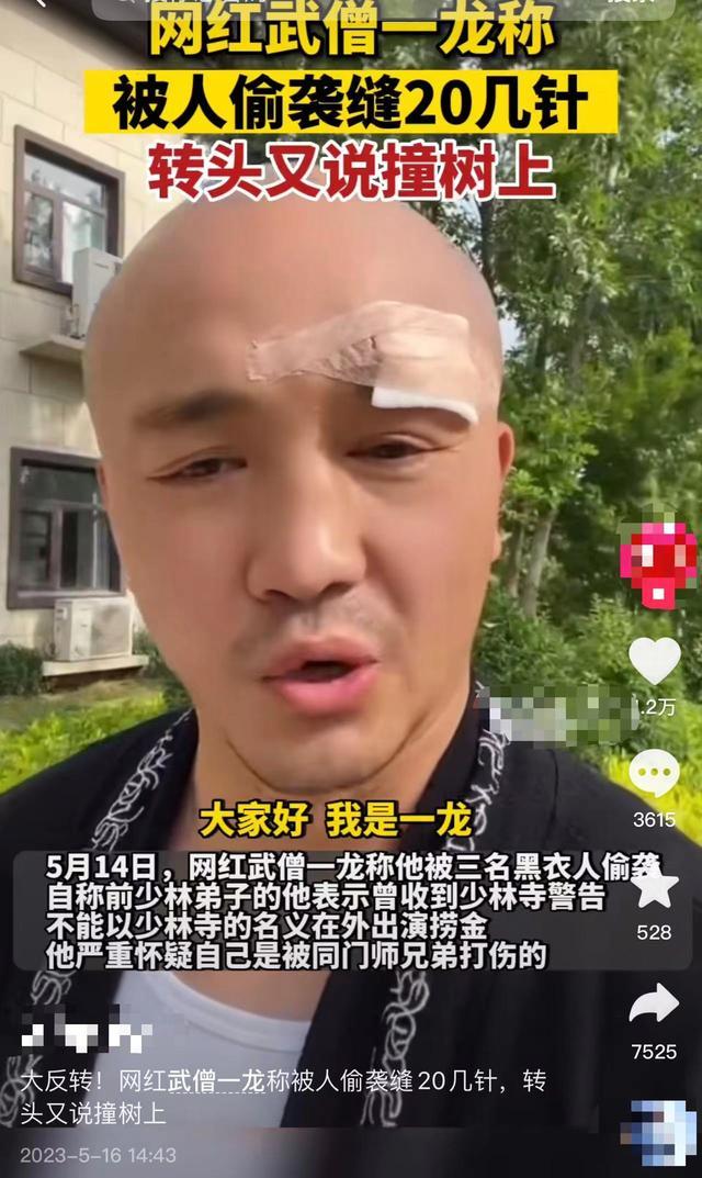 网红武僧一龙引争议，自曝遭3人围殴缝20几针，后改口称撞树上【EV棋牌】-EV棋牌